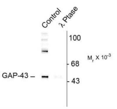 Western Blot: GAP-43 [p Ser41] Antibody [NB300-179]